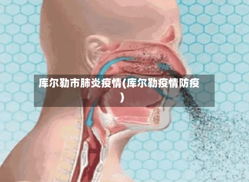 库尔勒市肺炎疫情(库尔勒疫情防疫)-第1张图片